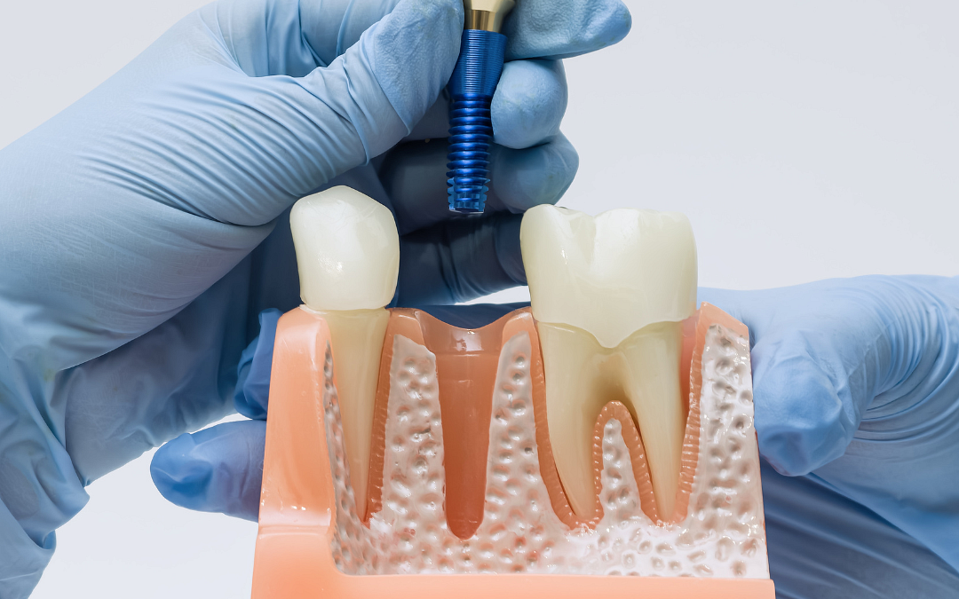 Dentysta po sąsiedzku. Jak zadbać o zęby na Mokotowie?